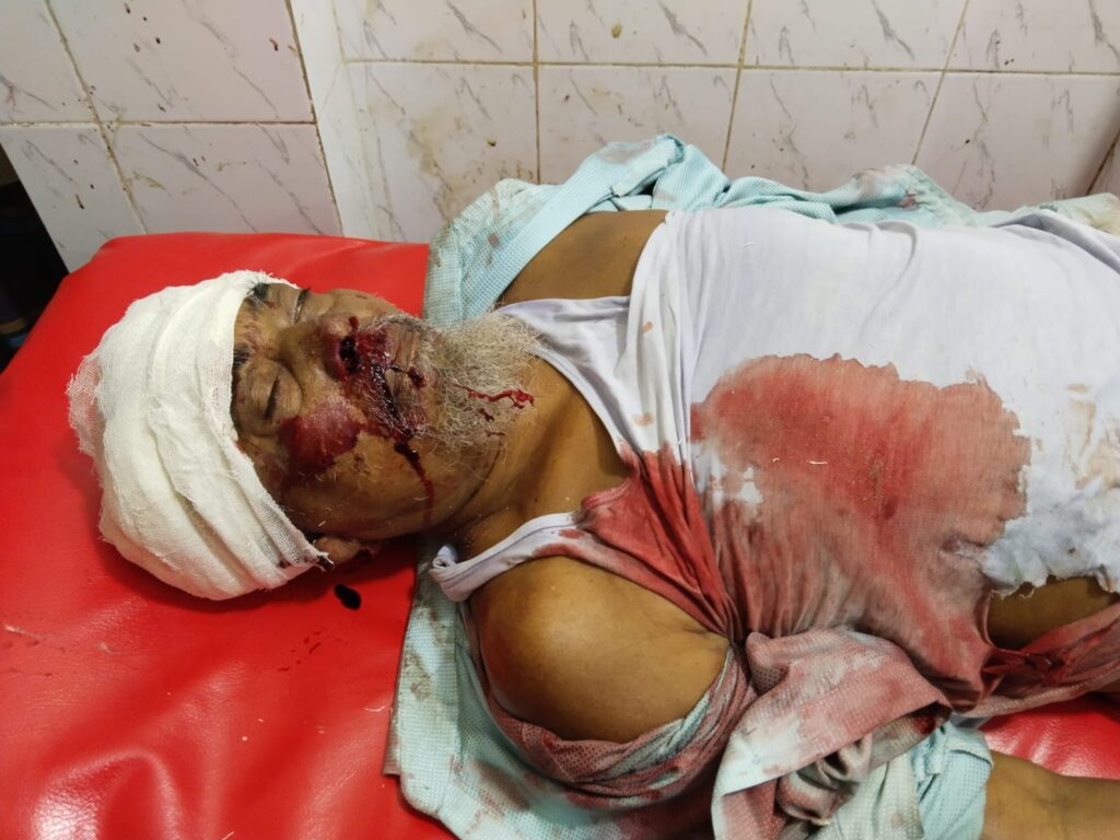 লালপুরে অটোরিকশার ধা/ক্কা/য় বৃদ্ধের মৃত্যু”