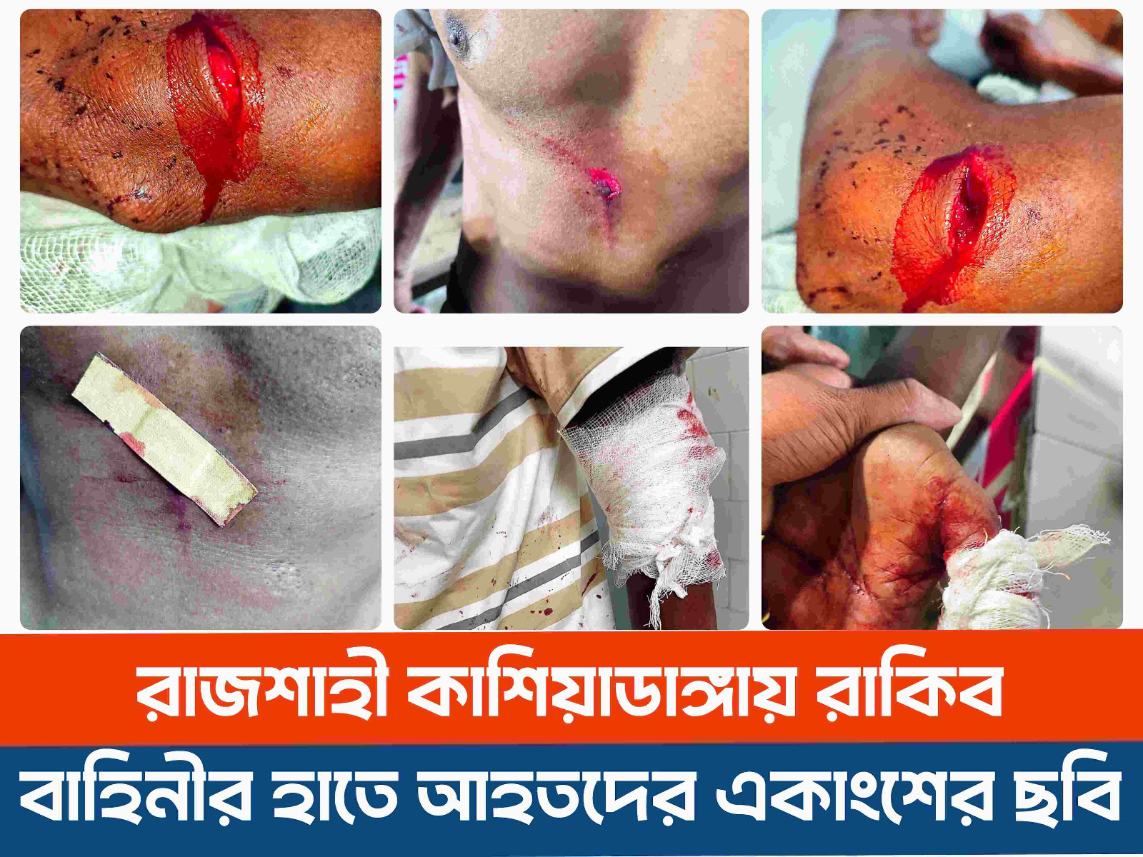রাজশাহী কাশিয়াডাঙ্গায় সংঘর্ষের ঘটনার নেপথ্যে কোন বাহিনী ?