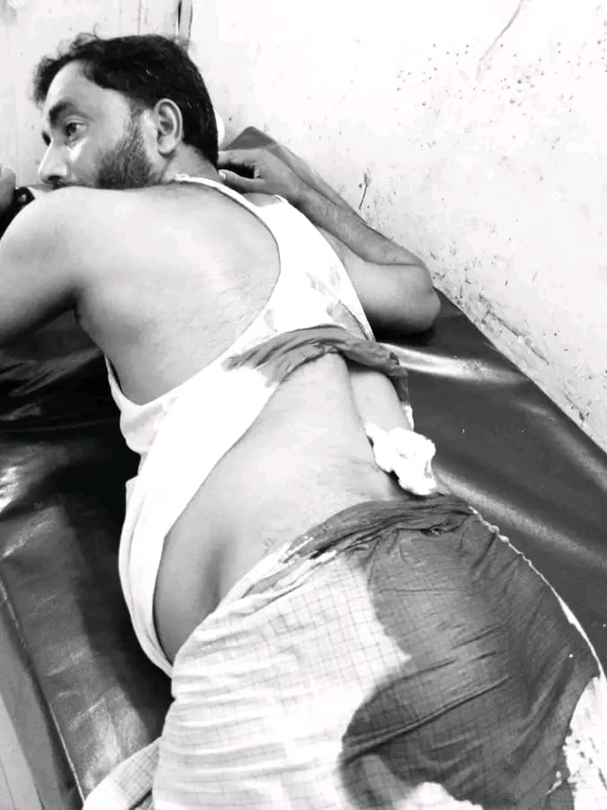 চট্টগ্রামের মীরসরাইয়ে বিএনপি নেতা মজিবুল হককে হত্যার উদ্দেশ্যে কুপিয়েছে দুর্বৃত্তরা