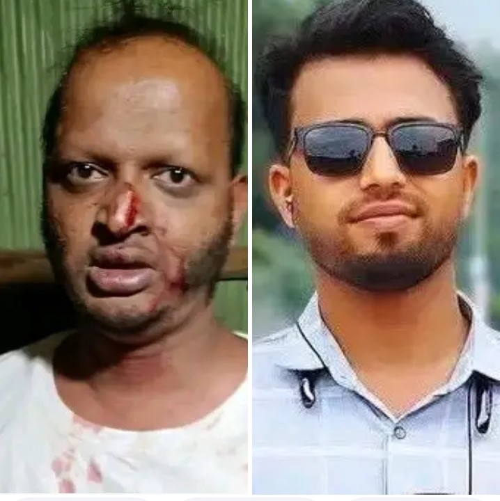 চট্টগ্রামের মীরসরাইয়ের করেরহাট এলাকায় সন্ত্রাসী হামলায় এক সাংবাদিক ও এক যুবদল নেতা আহত