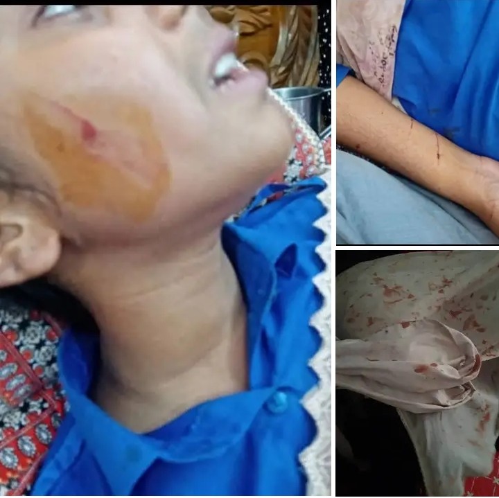 চট্টগ্রামের সীতাকুণ্ডে প্রাইভেট পড়তে যাওয়ার পথে স্কুলছাত্রীর ওপর হামলা, স্বর্ণালঙ্কার ছিনতাই, শিক্ষার্থীদের নিরাপত্তা দাবি